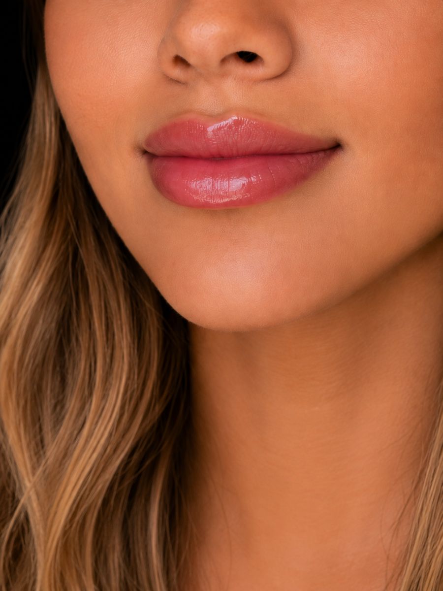 Resultado real Ekobell: Labios y perfil facial