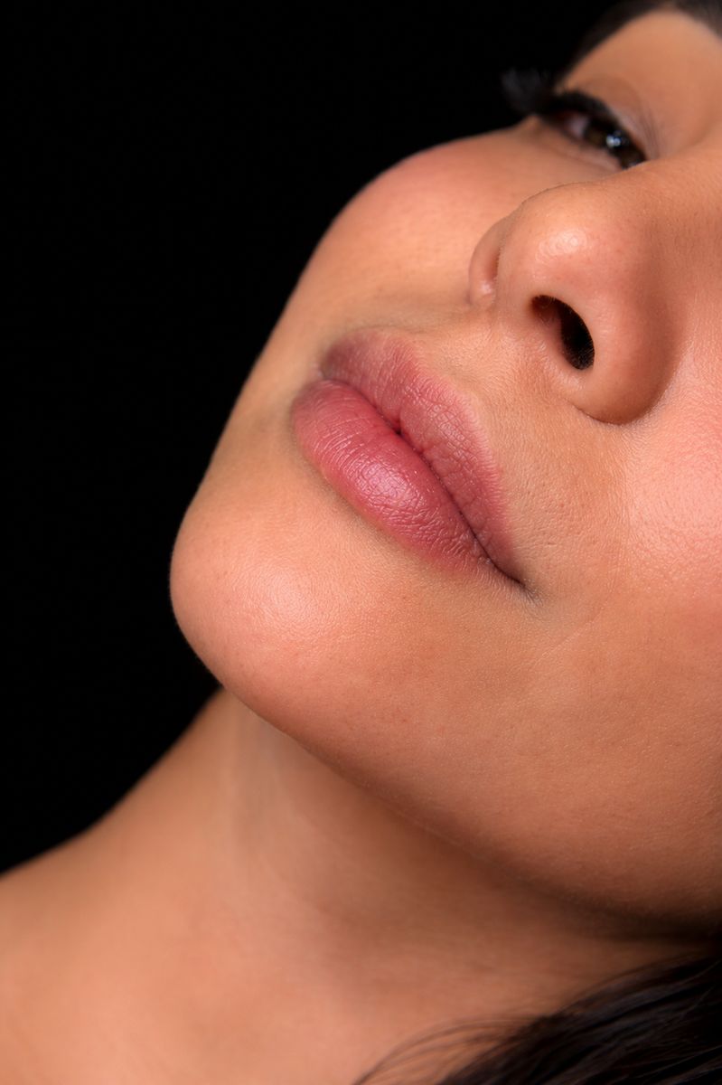 Resultado real Ekobell: Labios y perfil facial