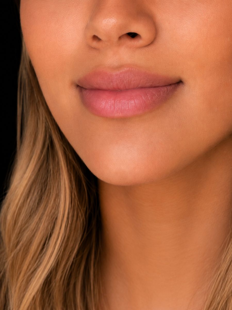 Resultado real Ekobell: Labios y perfil facial