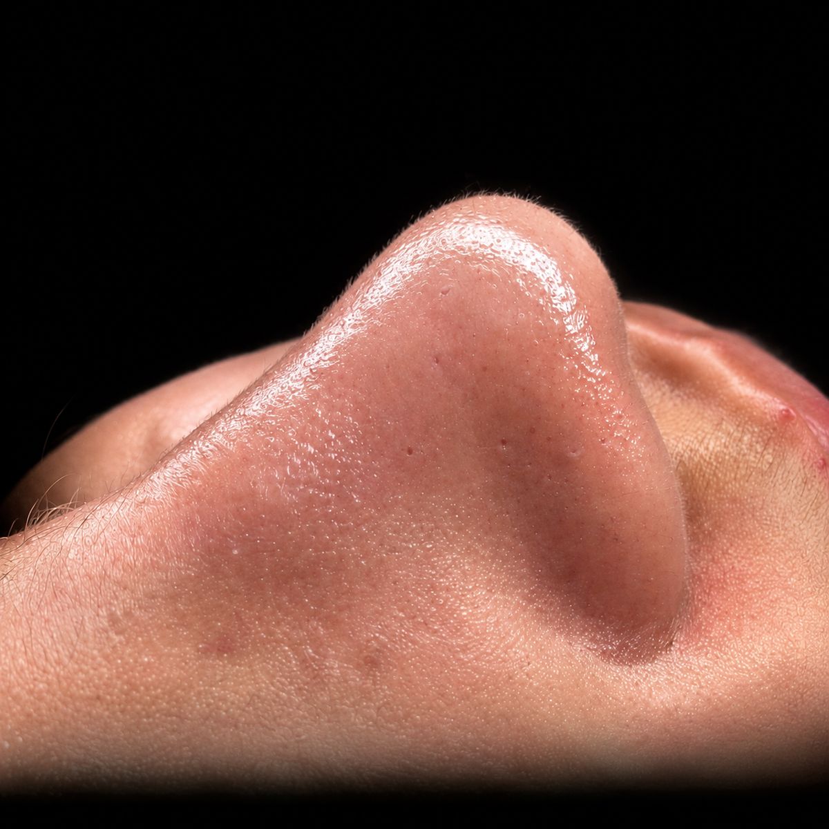 Resultado real Ekobell: Rejuvenecimiento facial