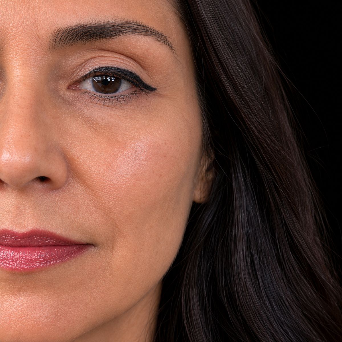 Resultado real Ekobell: Rejuvenecimiento facial