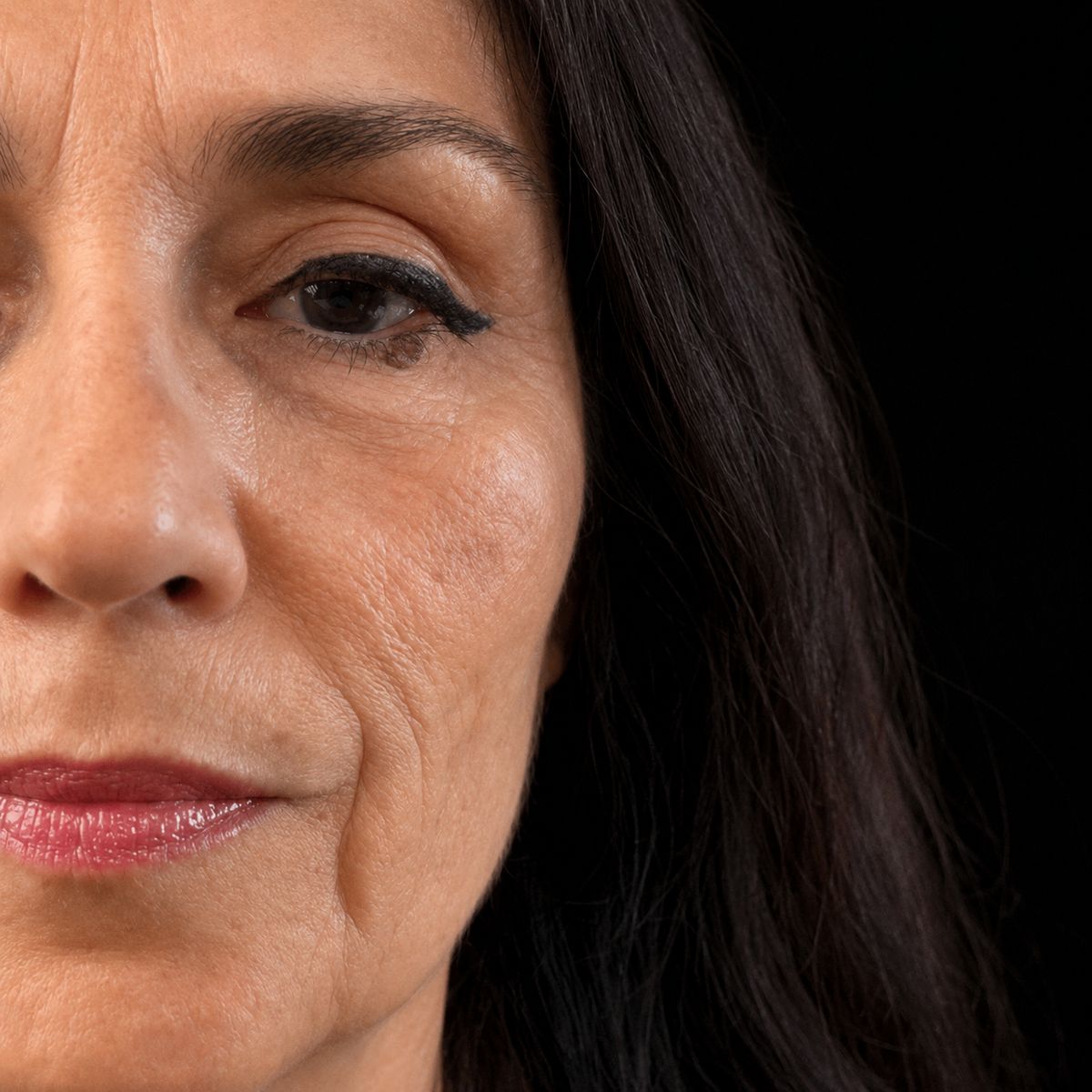 Resultado real Ekobell: Rejuvenecimiento facial