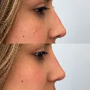 ChatGPT Image Mar 11, 2026, 09_33_43 PM.webp